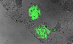 国内团队主导原创探索性研究 通过创新肾脏再生疗法完成前体细胞移植